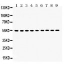 Vimentin  Antibody