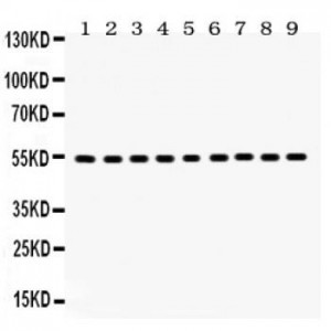 Vimentin  Antibody