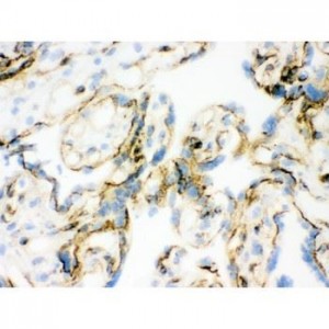 Vinculin Antibody (monoclonal)