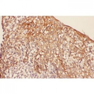 VR1 Antibody