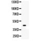 Wnt2b  Antibody