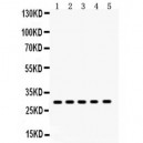 XBP1  Antibody