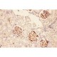 ACTH  Antibody