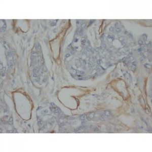 Collagen, Type IV Antibody (monoclonal)
