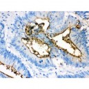 Episialin, EMA Antibody (monoclonal)
