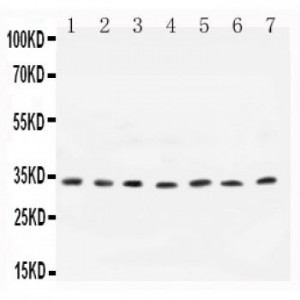  Cyclin D1 Antibody