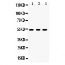 5HT2A Receptor  Antibody