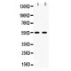 5HT2B Receptor  Antibody