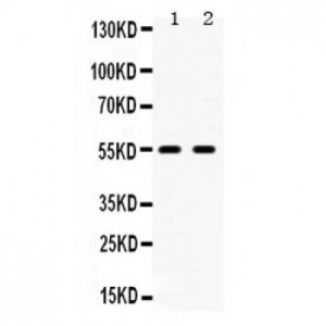 5HT2B Receptor  Antibody