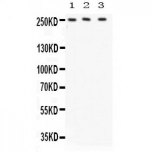 ABCA1  Antibody