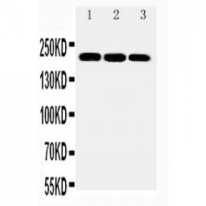 ABCA1 Antibody