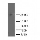 ABCA4 Antibody