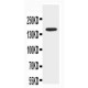 ABCB4 Antibody