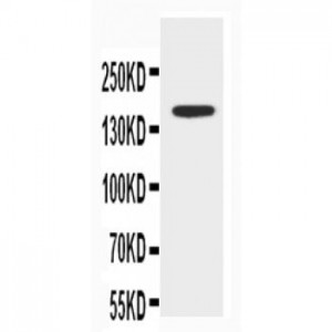 ABCB4 Antibody