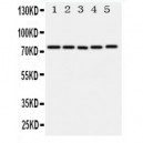 ABCG1 Antibody