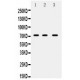 ABCG5  Antibody