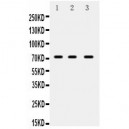 ABCG5  Antibody