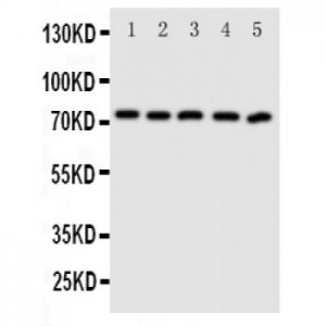 ABCG5 Antibody