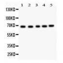 ACHE  Antibody