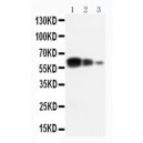 ADAM10 Antibody