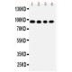 ADAM17 Antibody