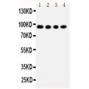 ADAM17 Antibody