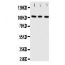 ADAMTS1 Antibody