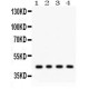 ADIPOR1  Antibody