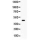 ADRB2  Antibody