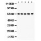 AGFG1 Antibody