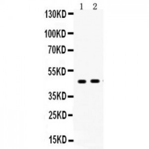 AGTR2  Antibody