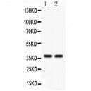 AHR  Antibody