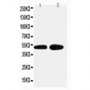 alpha 2a Adrenergic Receptor Antibody - Novatein Biosciences