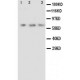 Angiopoietin 2 Antibody