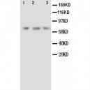 Angiopoietin 2 Antibody