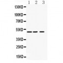 Angiopoietin-like 4