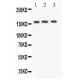 Angiotensin Converting Enzyme 1 Antibody