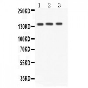 Angiotensin Converting Enzyme 1 Antibody