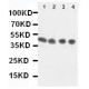 Annexin VIII Antibody