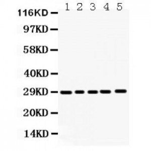 APH1a  Antibody