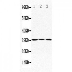 Apolipoprotein D Antibody