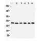 Apoptosis repressor with CARD Antibody