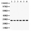 APRIL  Antibody