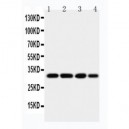 Aquaporin 5 Antibody