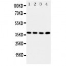 Aquaporin 7 Antibody