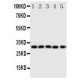 Aquaporin 9 Antibody