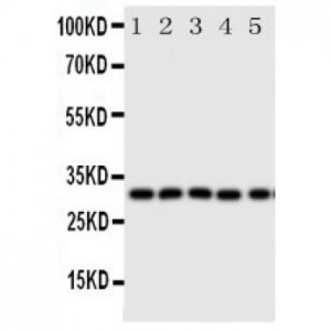 Aquaporin 9 Antibody