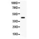 Arc Antibody