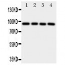 Aryl hydrocarbon Receptor Antibody