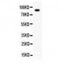 Ataxin 1 Antibody